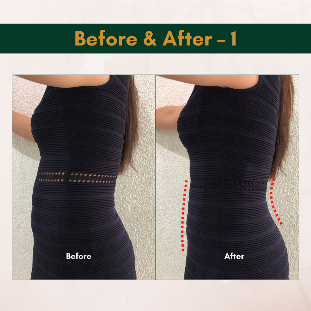 Esmé Impression Slim Wear Girdle Body Shaper